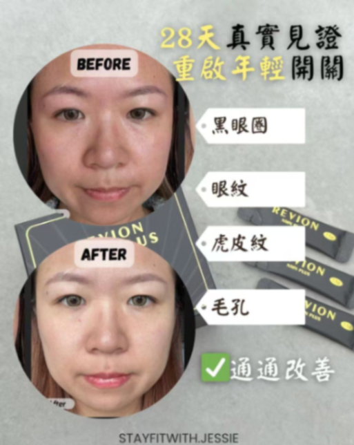 REVION NMN PLUS Oral Health Supplement63368983608962113